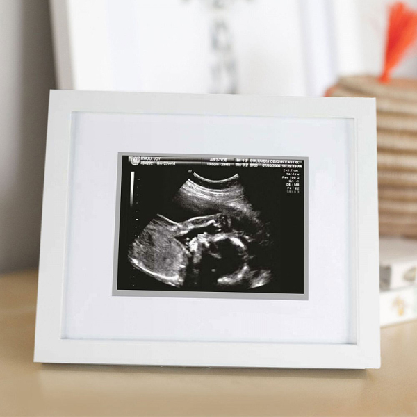 Αναμνηστική Κορνίζα Μωρού Για Υπερηχογράφημα (10x15) Pearhead Sonogram Small PH-P63015
