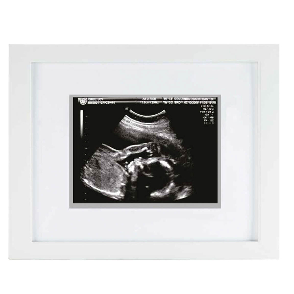 Αναμνηστική Κορνίζα Μωρού Για Υπερηχογράφημα (10x15) Pearhead Sonogram Small PH-P63015