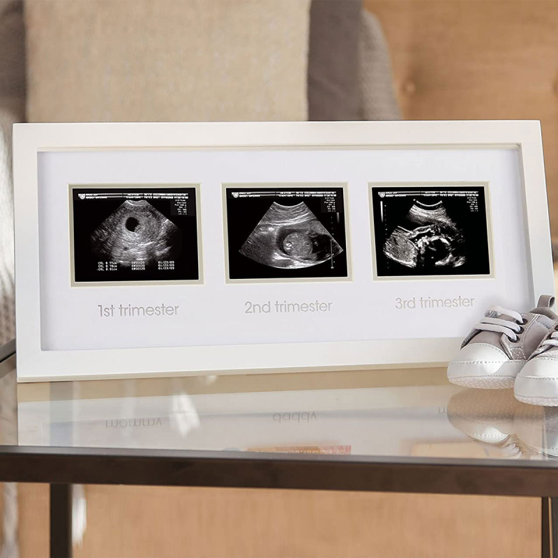 Αναμνηστική Κορνίζα Μωρού 3 Θέσεων Για Υπερηχογράφημα (7x10) Pearhead Coming Soon PH-P63016